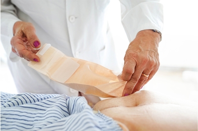 How an Ostomy Specialist Supports Your Care