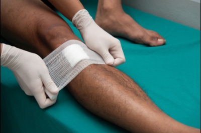 Conservative and Advanced Care for Chronic Leg Wounds