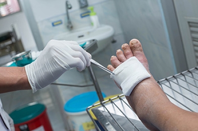 When Lower Extremity Ulcers Have Different Causes