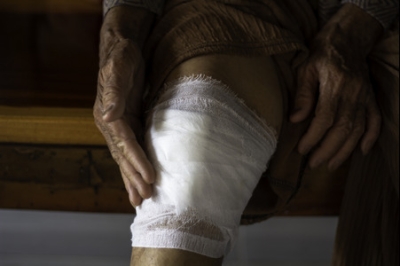 Treating Lower Extremity Cuts and Abrasions