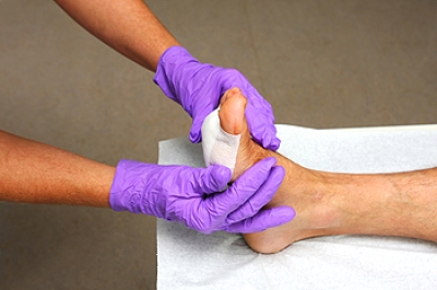 How Negative Pressure Wound Therapy Helps Diabetic Foot Wounds Heal