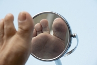 Understanding Chronic Wounds on Legs and Feet