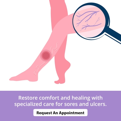 Specialized Care for Pressure and Circulatory Ulcers