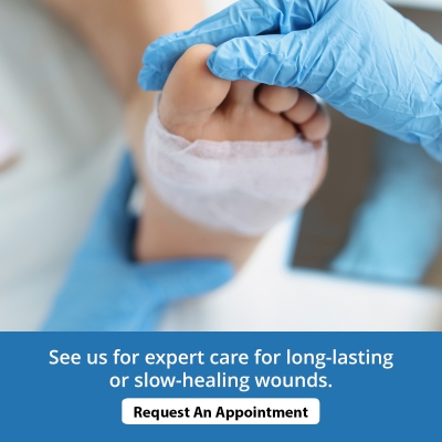 Advanced Care for Chronic Wounds